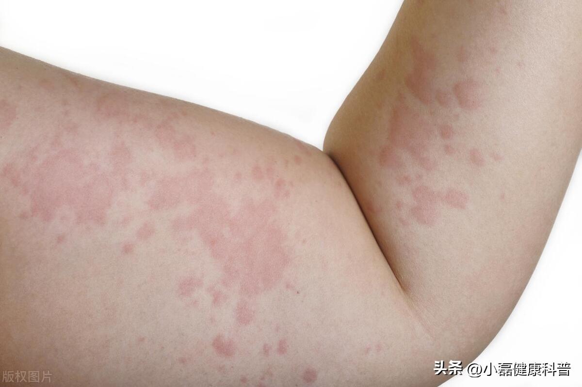 養(yǎng)生吃什么堅(jiān)果好_吃堅(jiān)果養(yǎng)生嗎_養(yǎng)生堅(jiān)果吃好還是吃好